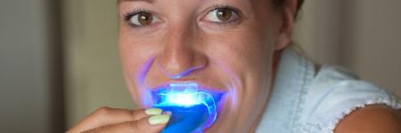 Dertig Spookachtig gouden Tanden bleken thuis - review