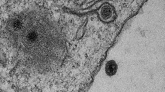 Scientists discover virus with no recognizable genes