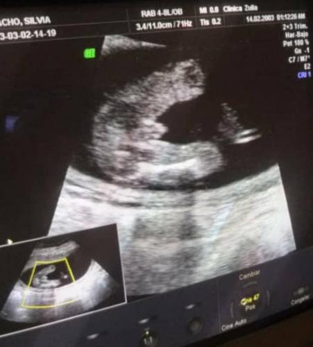 Fotografía en blanco y negro