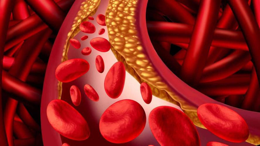 What is cholesterol?