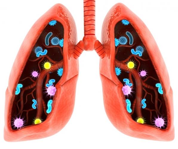 What are the Symptoms of Pneumonia?