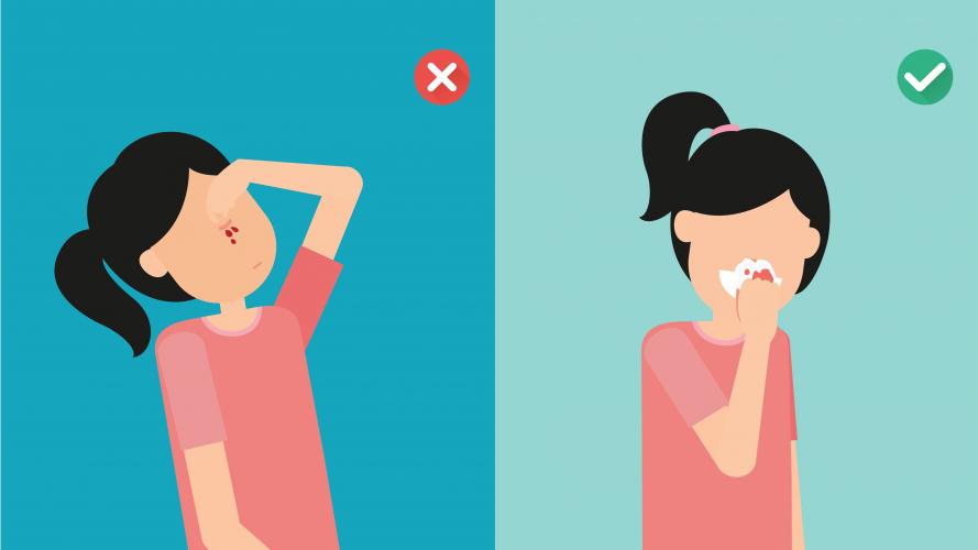 How to stop nose bleeding?