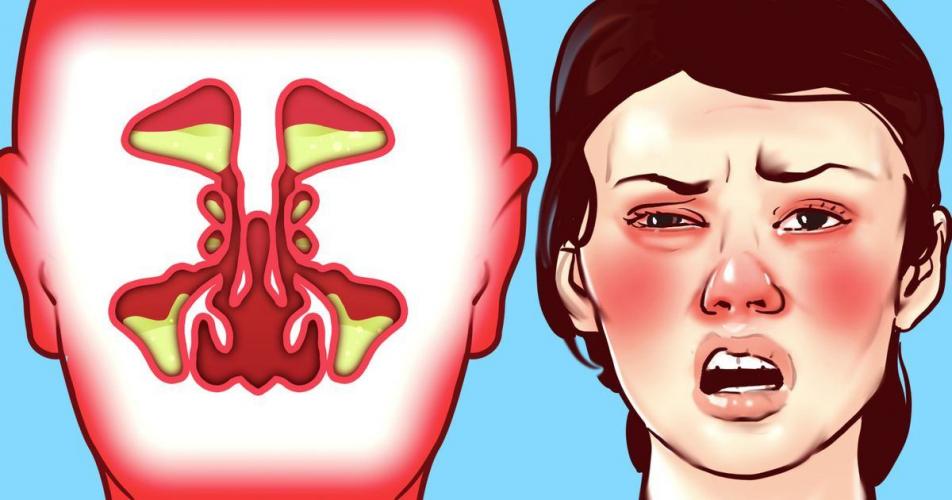 How to stop stuffy nose 