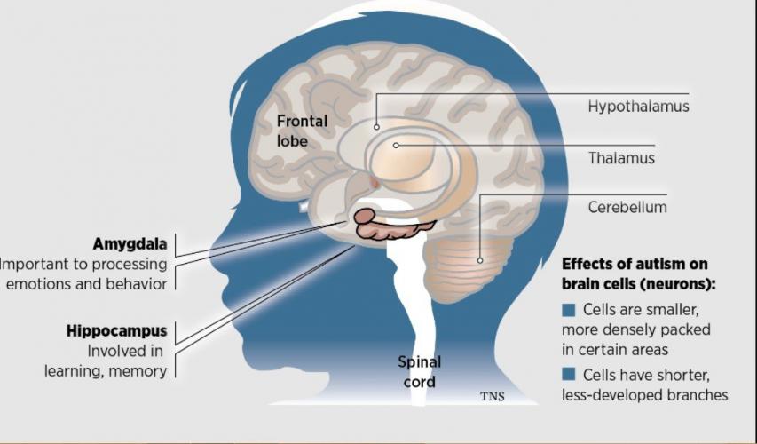 What is Autism and What Causes Autism?