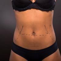 Ashby Plastic Surgery &amp; Laser Medical Spa