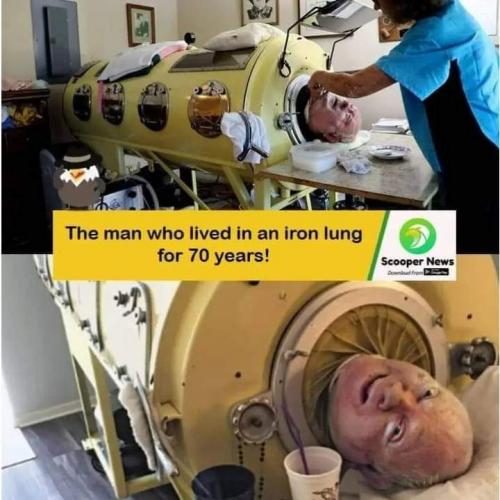 ‼️ Man who Lived 70 Years On Oxygen