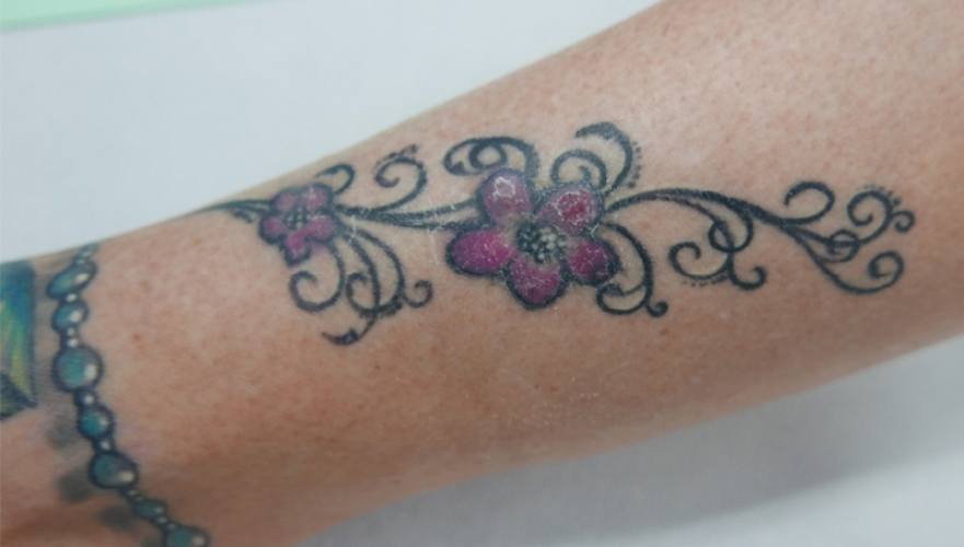 Een jeukende tatoeage