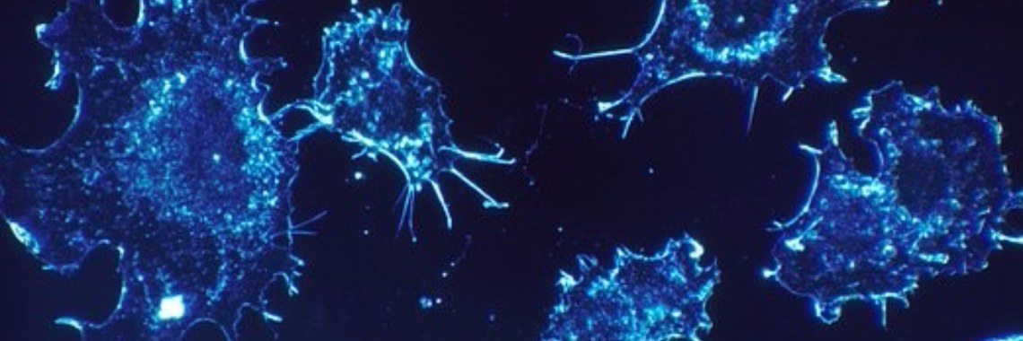 BRCA2 gen. Oh nee toch? | Vlindertje73