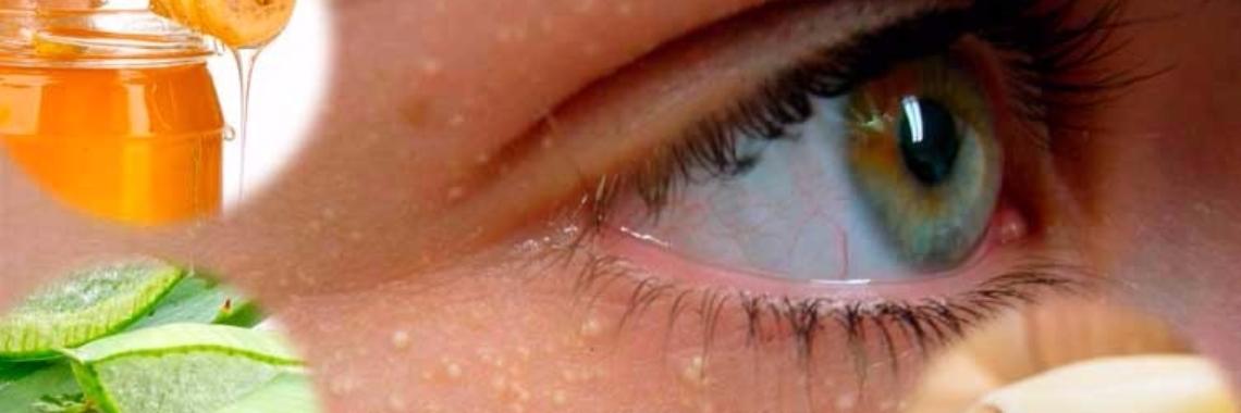 Natuurlijke manieren om van die witte bobbeltjes af te raken | Yoors World