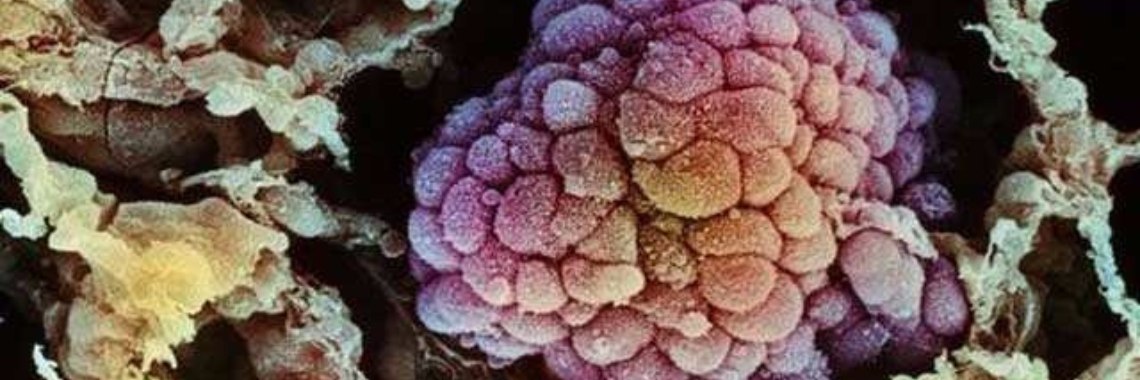 Groente boordevol anthocyanine die je gewoon thuis kan kweken | Yoors World