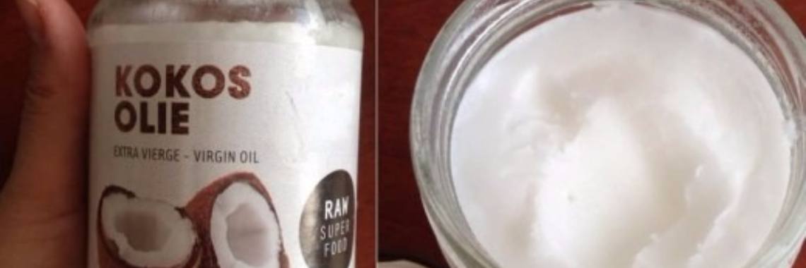 Kokosolie: Goed of slecht voor acne? Soorten en gebruiken op een rij. | Yoors World