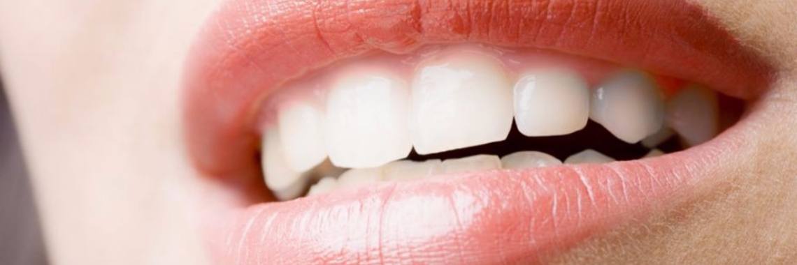 Je tanden een tint witter op een natuurlijke wijze. | Yoors World