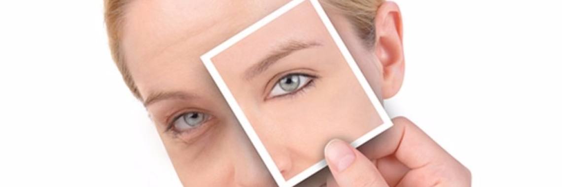 Koffiedik om oogwallen te bestrijden en 10 extra tips om koffiedik te gebruiken. | Yoors World