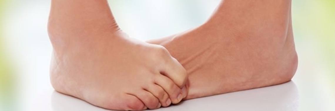 Met deze natuurlijke behandelingen raak je verlost van eksterogen | Yoors World