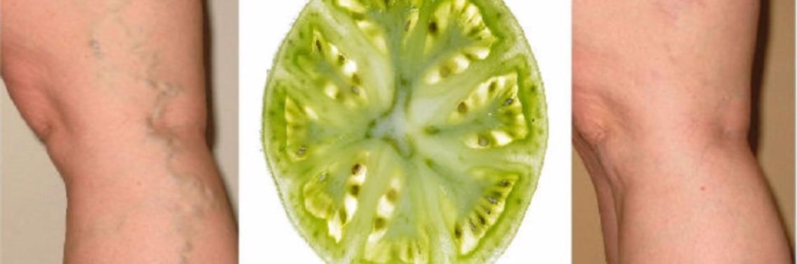 Spataderen genezen met behulp van tomaten | Yoors World