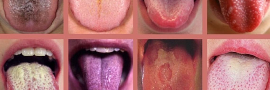 Say aaa, look at your tongue a little more often, she says a lot about your health | Yoors World