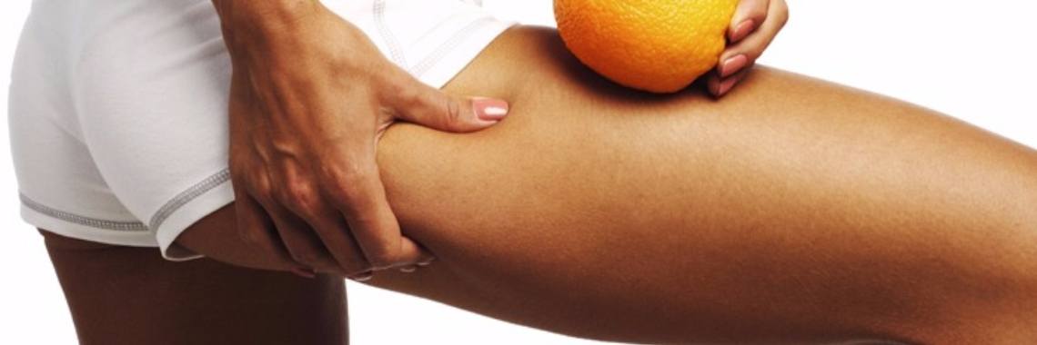 De juiste voeding en aromatherapie kunnen cellulitis voorkomen | leefnugezonder