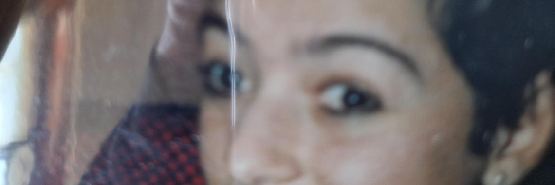Brain surgery took my hair away and trauma turned my eyes wrongly | Paula Martins
