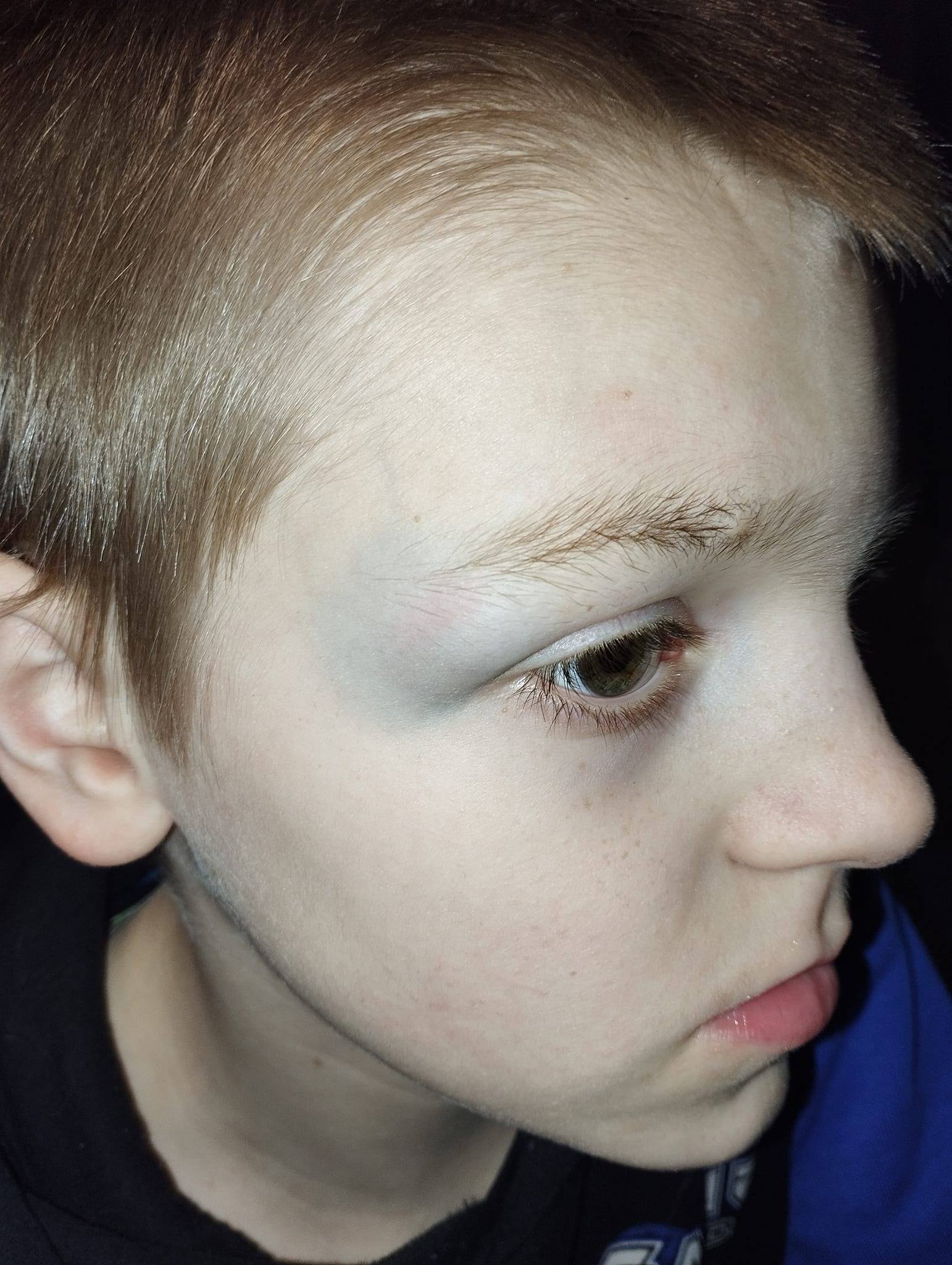 Ongelukje Deel2 | Rosita&Charlene-Blogs-Creaties