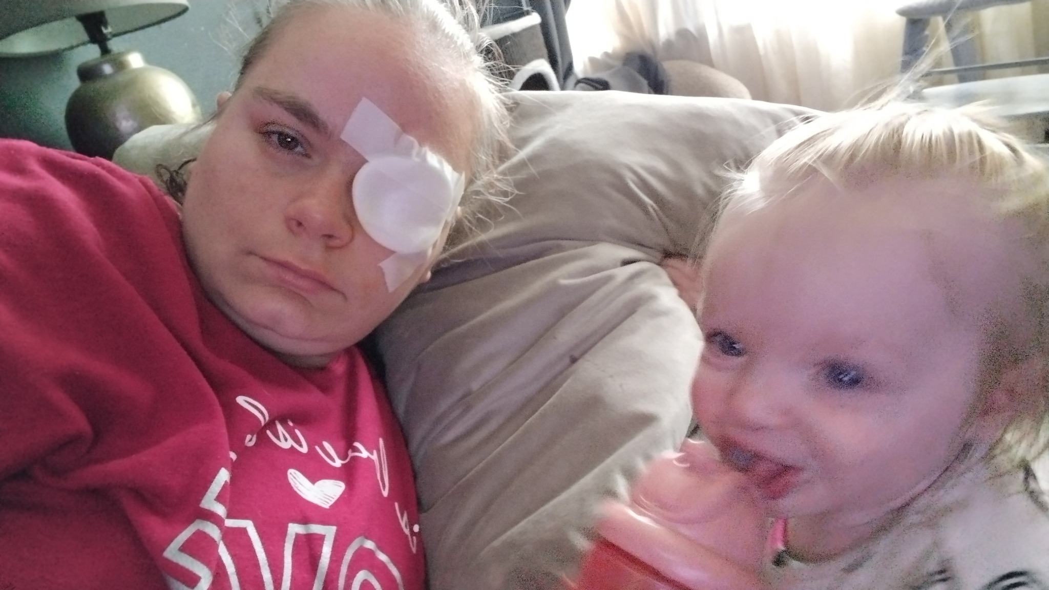 Oog beschadiging | Rosita&Charlene-Blogs-Creaties