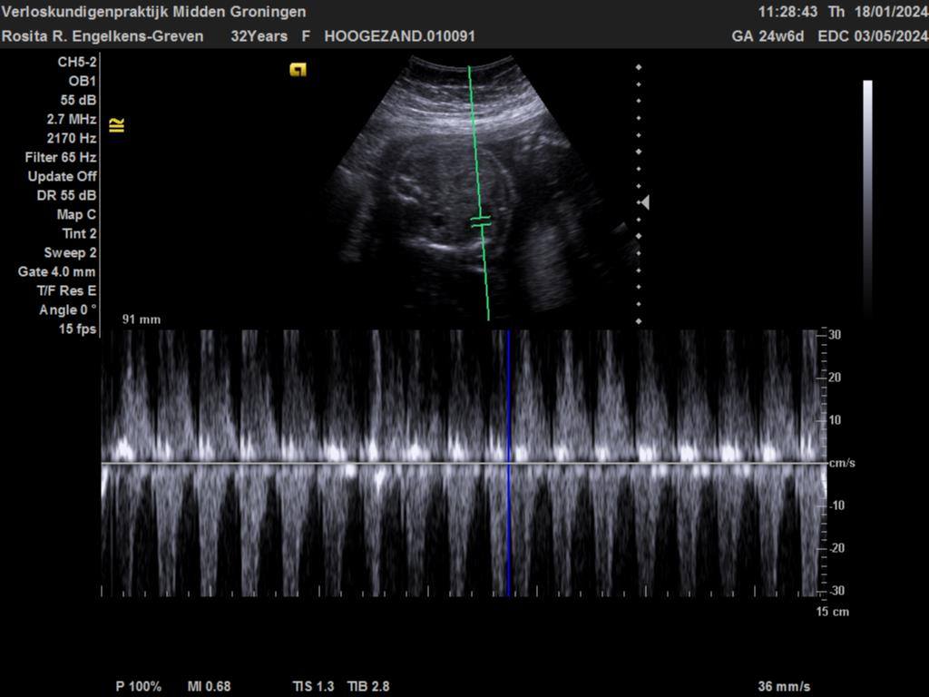 Echo 24 week en 6 dagen zwangerschap | Rosita&Charlene-Blogs-Creaties
