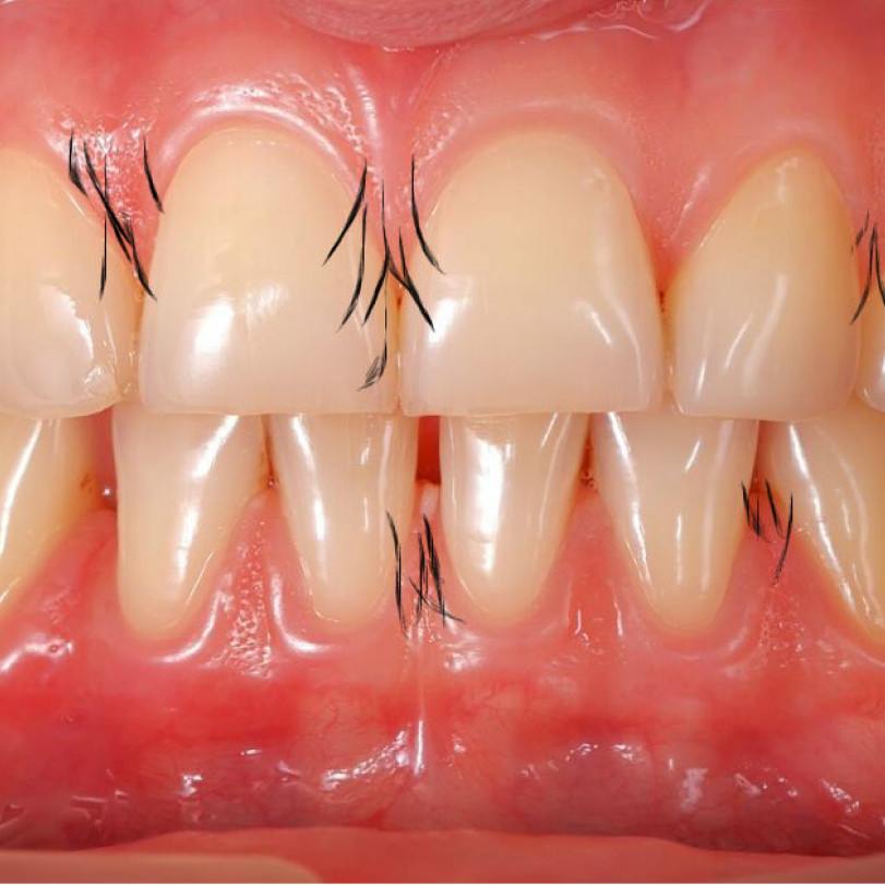 Sueño extraño | leninJM