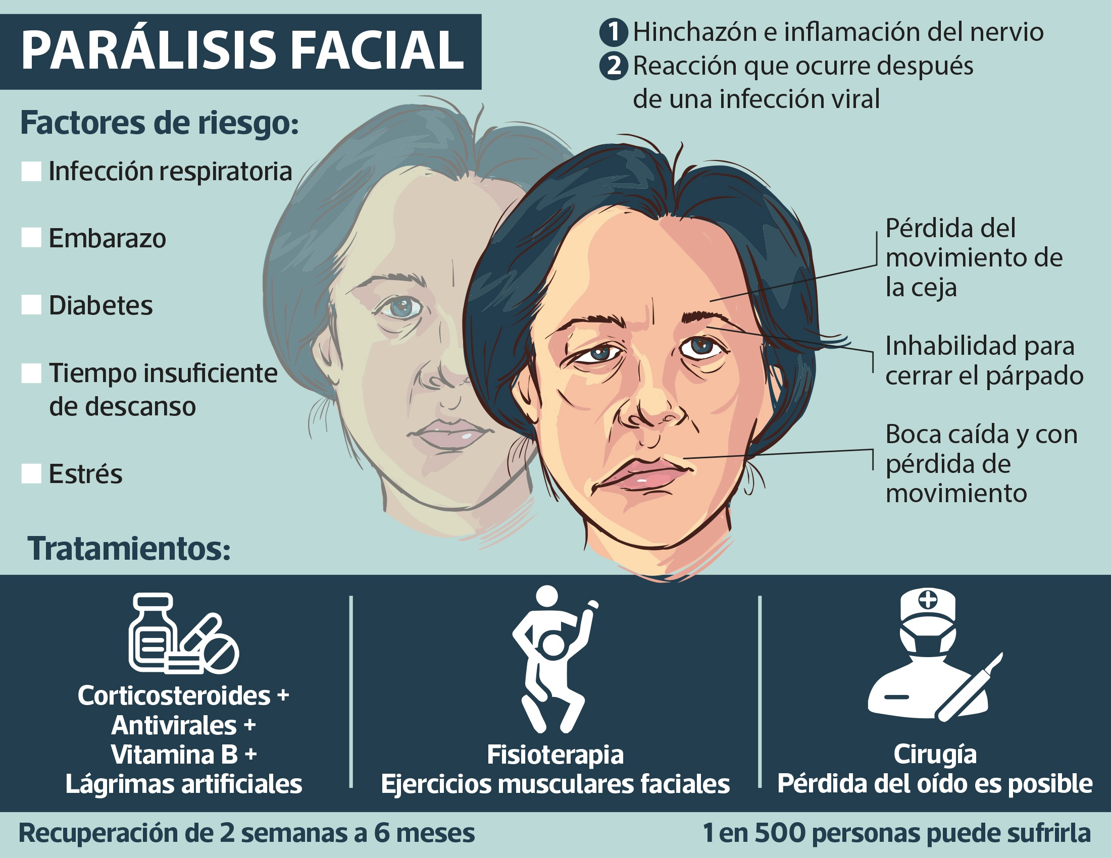 Conquering Bell'S Palsy: Lessons From Joyce Vance - 1q56kgi