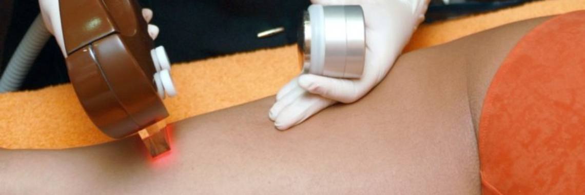 can-insurance-cover-laser-hair-removal