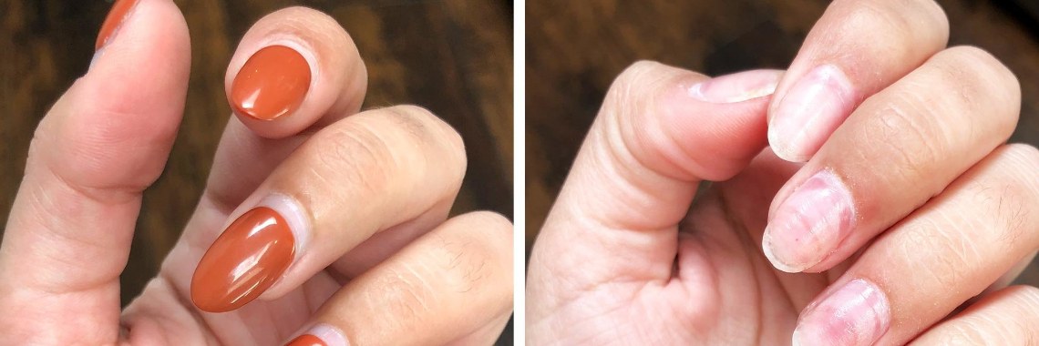 How To Take Off Acrylic Nails?