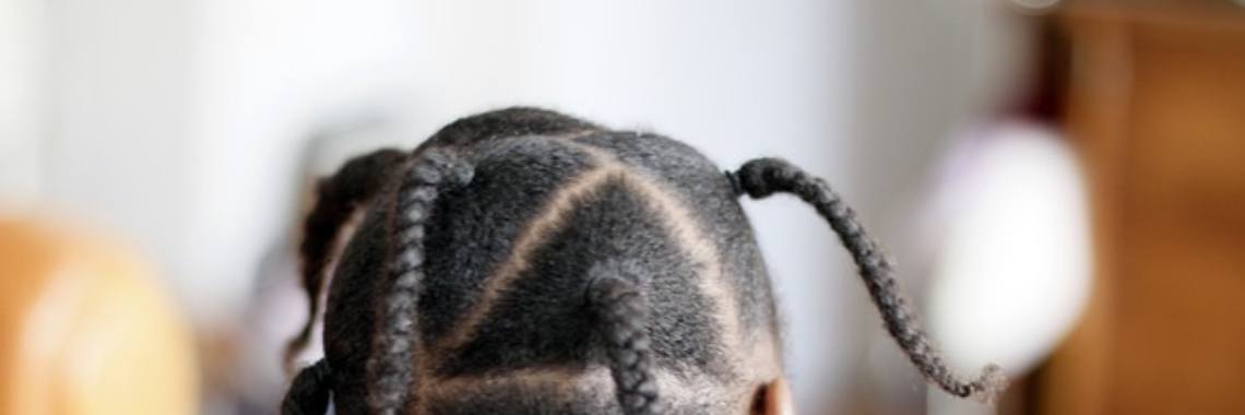 How to stop hair loss | Ogochukwu Ugwu