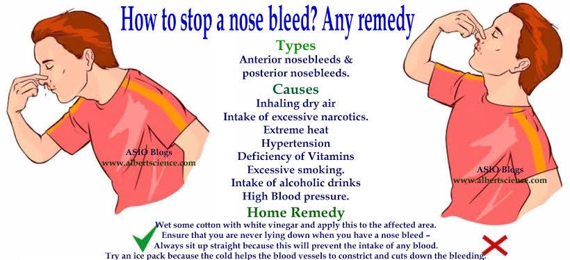 how-to-stop-nosebleeds-yoors