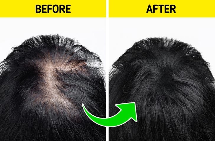 Tips to naturally regrow your hair