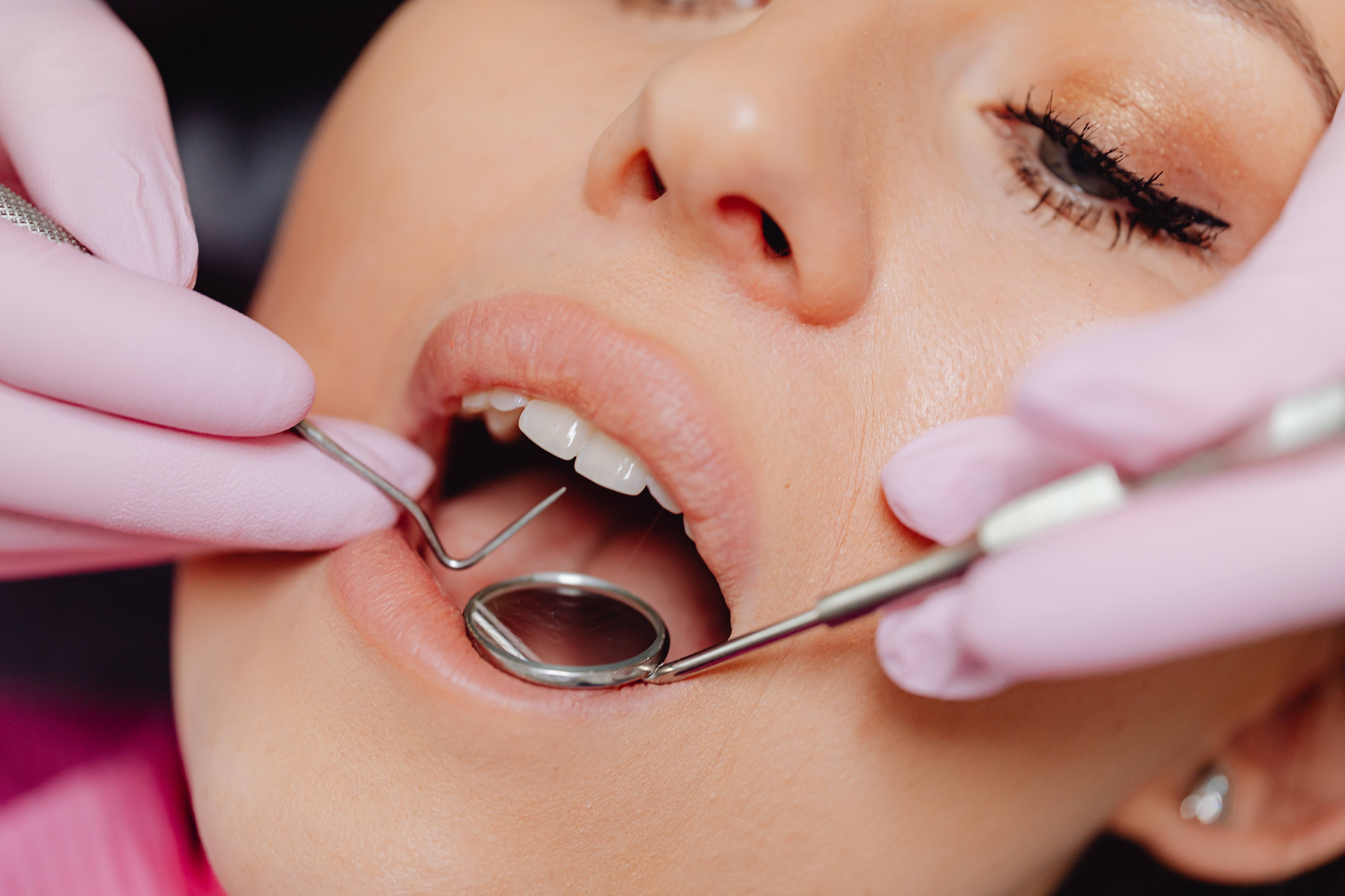Dental Implants Versus Your Natural Teeth