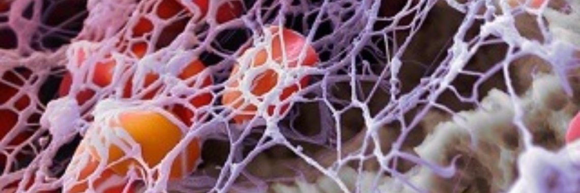 Gedichten uit 'Perpetuum Mobile' door Rudi J.P. Lejaeghere: 22. Stolling | Rudi