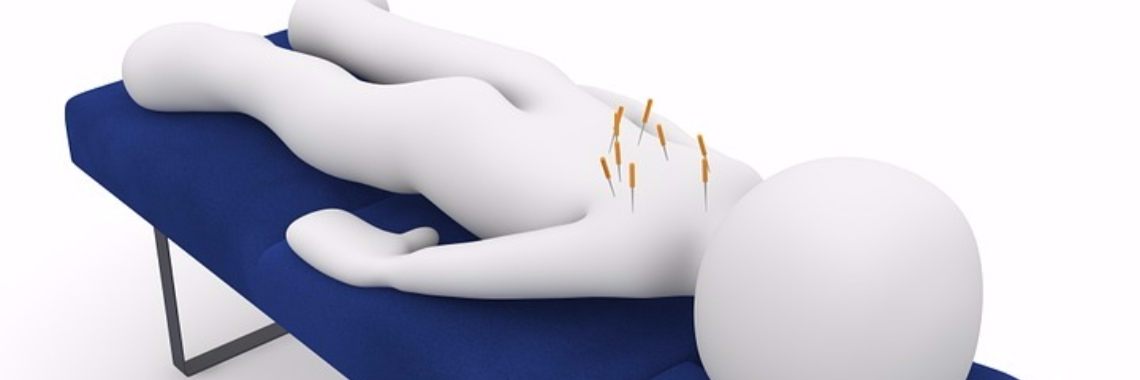 Dry needling. | sylbibj