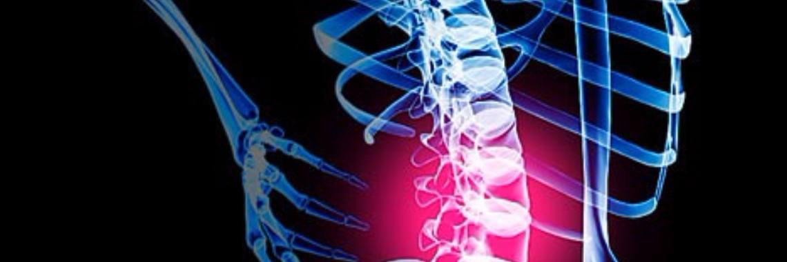 Hoe kom ik nu aan fibromyalgie? | Roodkapje