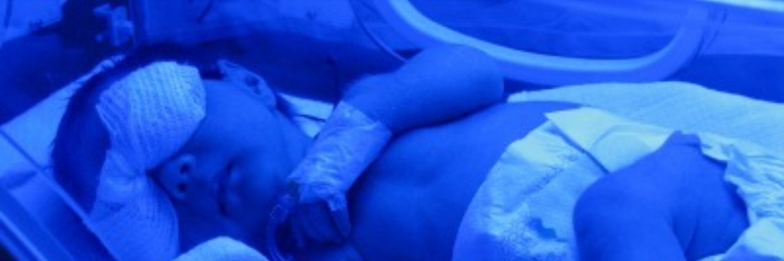 Lichttherapie, waar dient dat voor? | Roodkapje