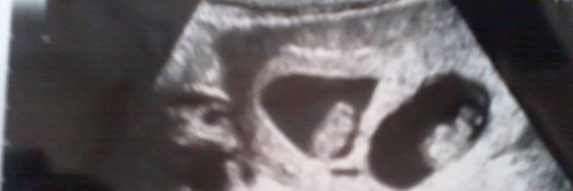 My twins pregnancy | Ramona Vroom