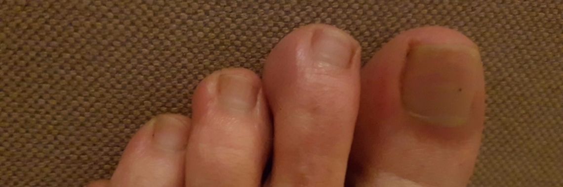 Wintertenen! HELP!! | Joyce de Boer