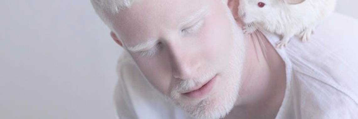 Albino. | Mell Catsoul