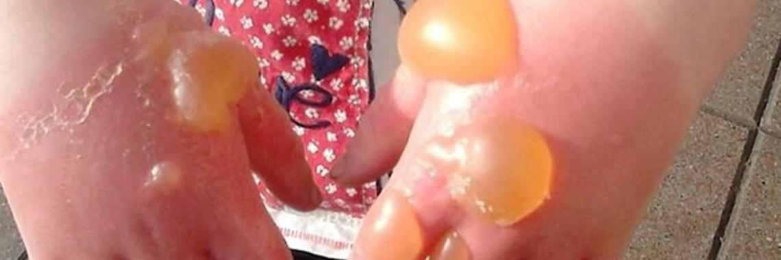 (Reuzen)Berenklauw, niet aanraken! | DidI'Ms world