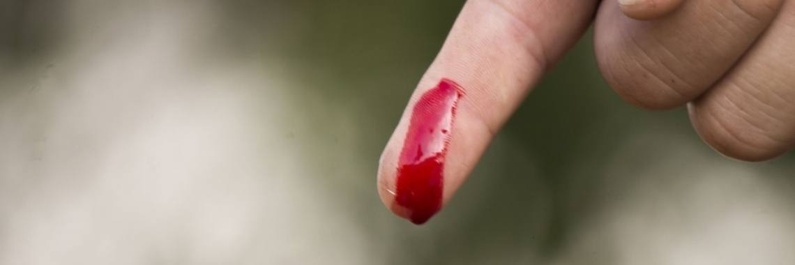 Waarom doet een sneetje veroorzaakt door papier zo zeer?  | DidI'Ms world