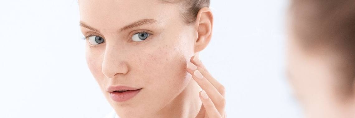 Dit zegt de plek van jouw acne over jouw gezondheid | Marilyn - Beauty by Lynn