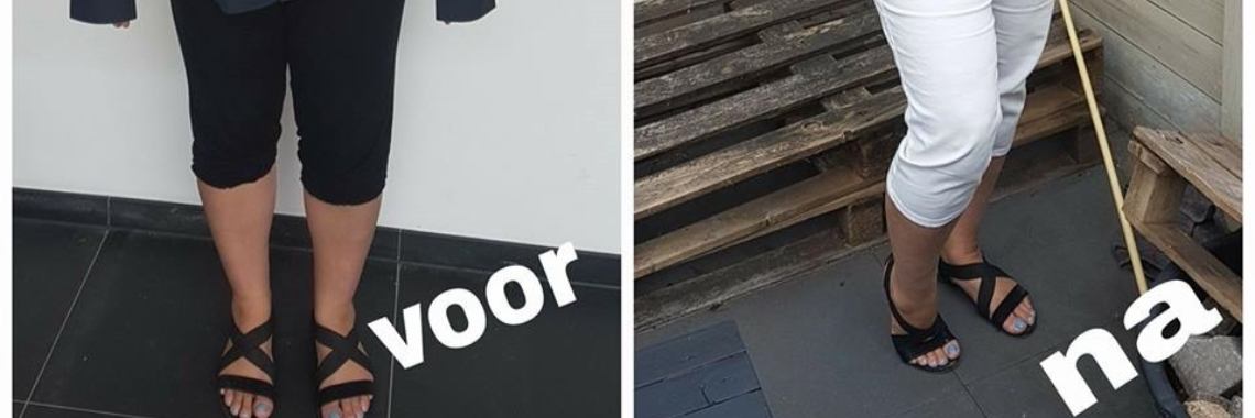 Recykleren / Overhemd | bijlenie