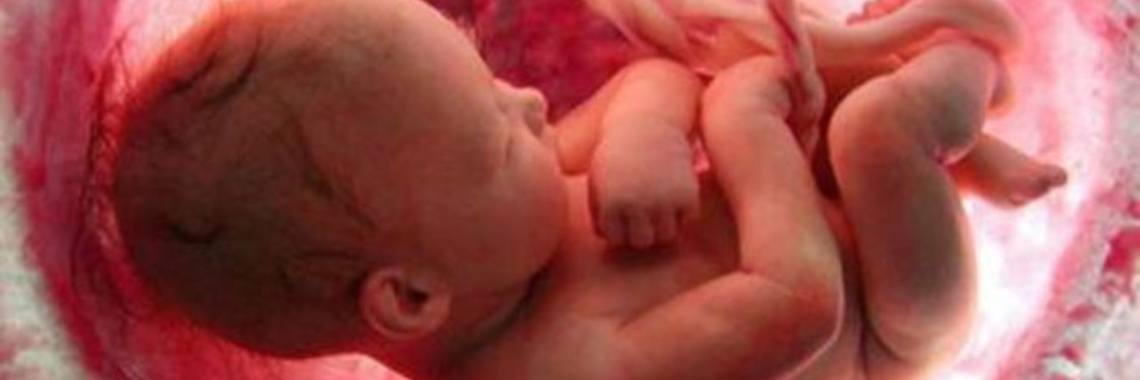 Het leed dat Foetaal alcohol syndroom heet!  | Daimster