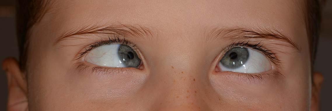 Suiker, krijg jij er al hoofdpijn van? | Rassi Health&Beauty