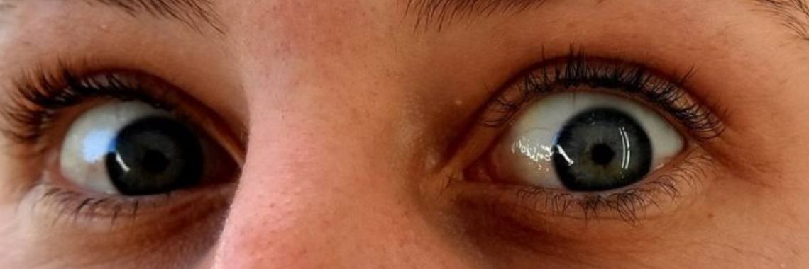 Top 40 dingen die je niet tegen kankerpatiënten moet zeggen | Jessica Bek