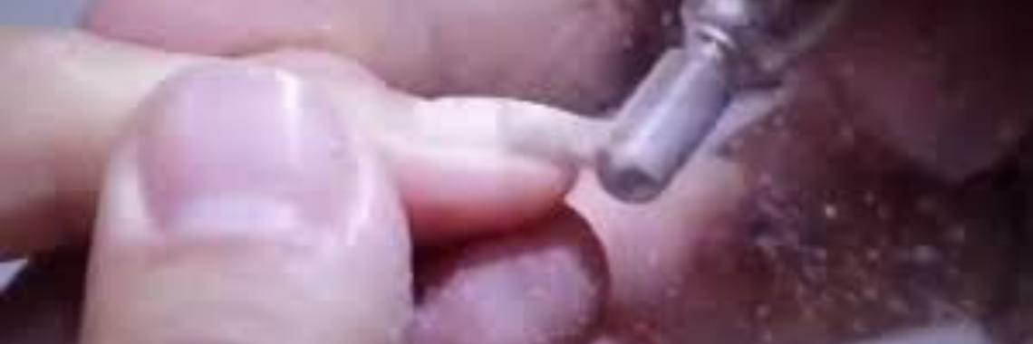 Gellak sneller verwijderen ; frees met safety bit  | AgnesDeventer