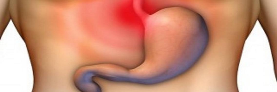 Brandend maagzuur, ook een oorzaak van te weinig maagzuur | Nyquole