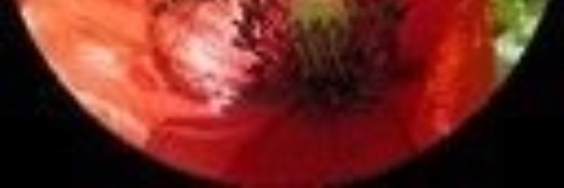 This is my life - Zwartwit 10-daagse (1) | Flying Eagle